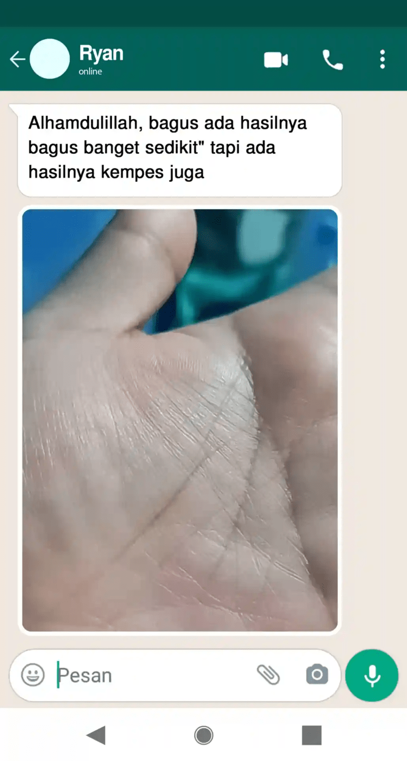 -