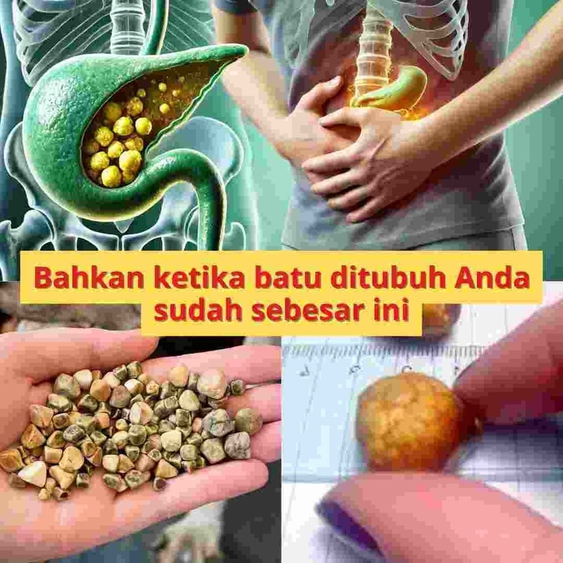 head paduseha - bahkan ketika batu ditubuh anda sudah sebesar ini