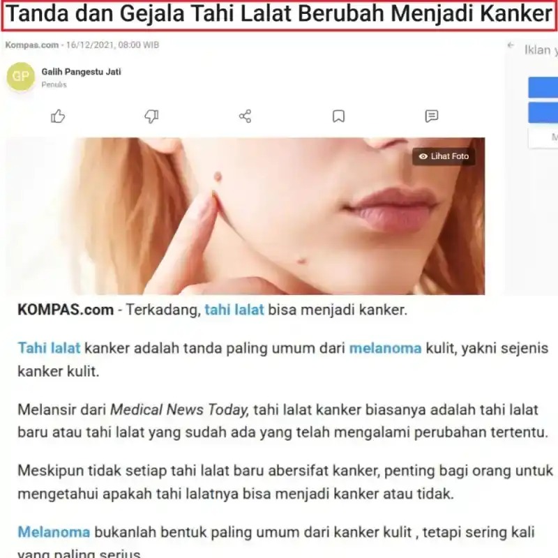 -