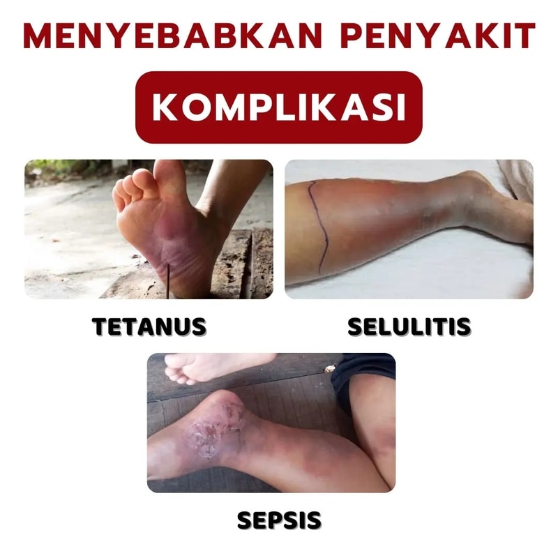-
