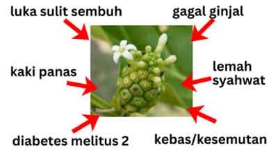 Ilustrasi Gagal Ginjal