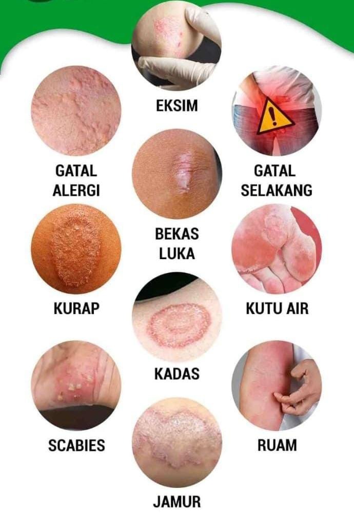 -