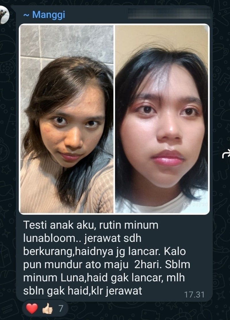 -