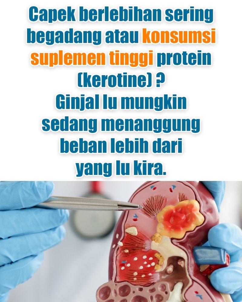 -