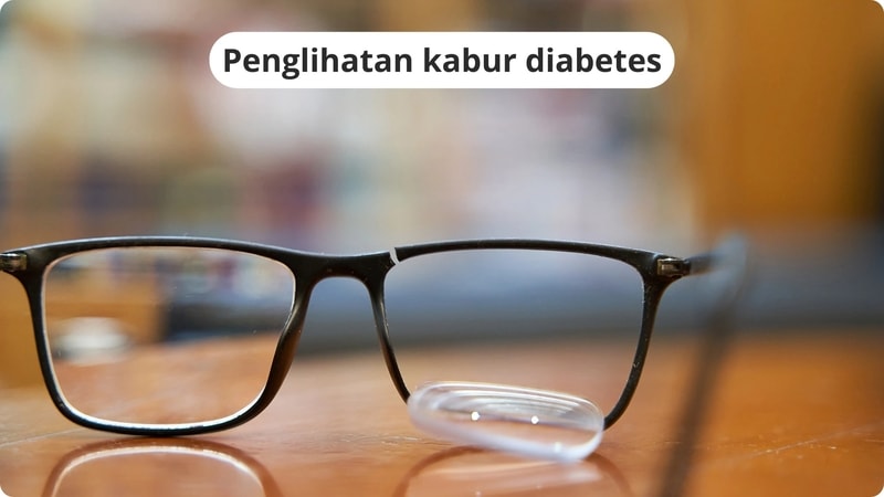Penglihatan kabur