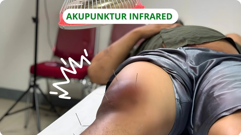 akupunktur infrared