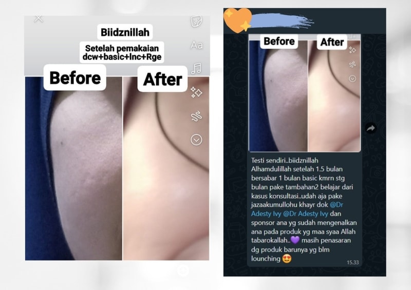 -