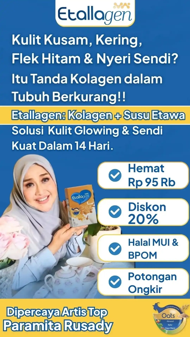 Brand Ambassador Etallagen adalah Paramitha Rusady
