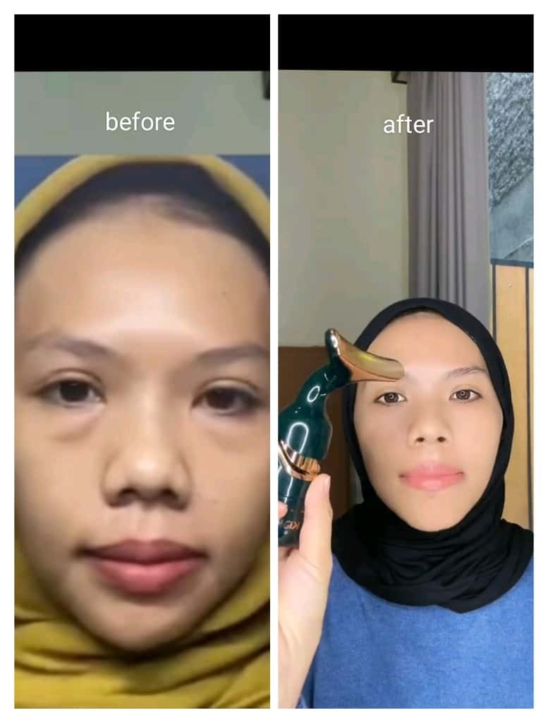 -