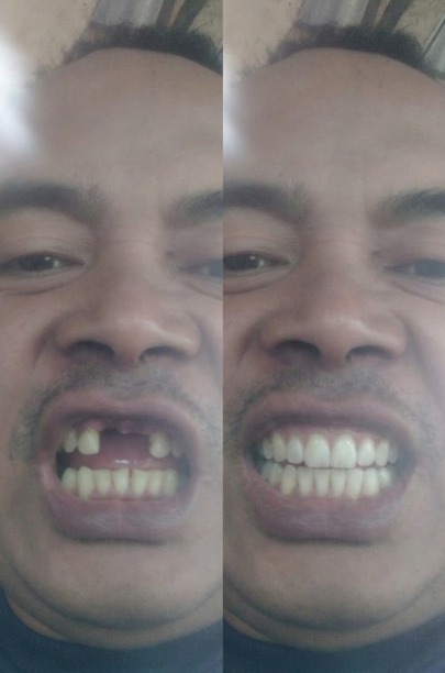 -