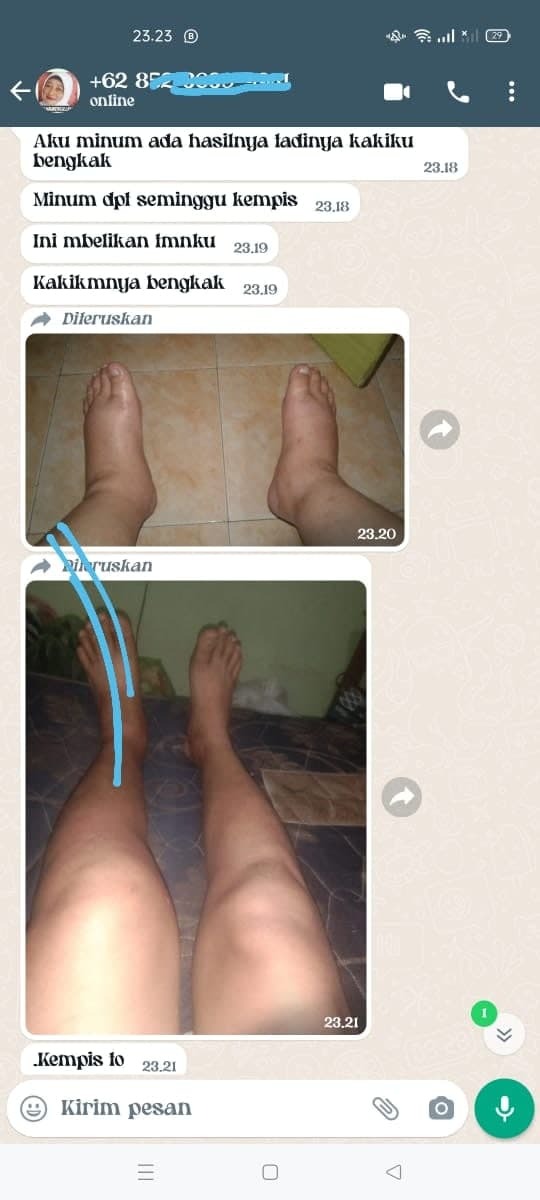 -