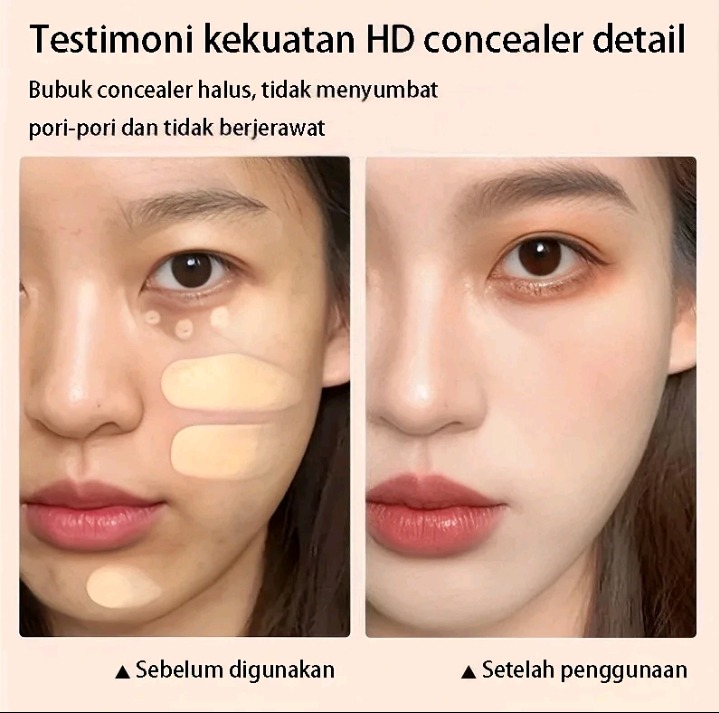 Krim Penghilang Flek Kulit 5