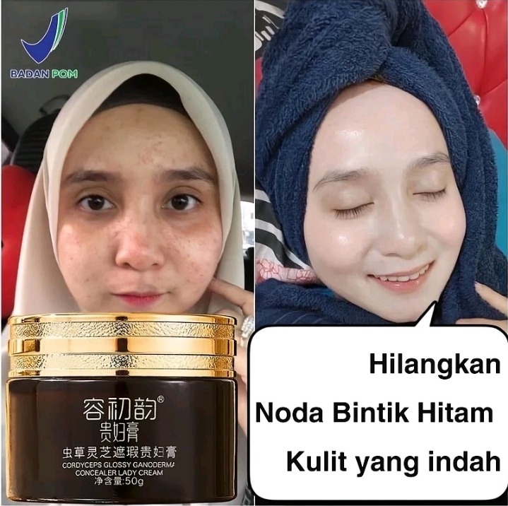 Krim Penghilang Flek Kulit 3