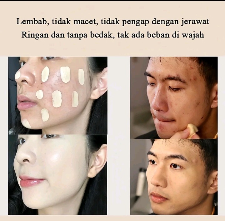 Krim Penghilang Flek Kulit 4