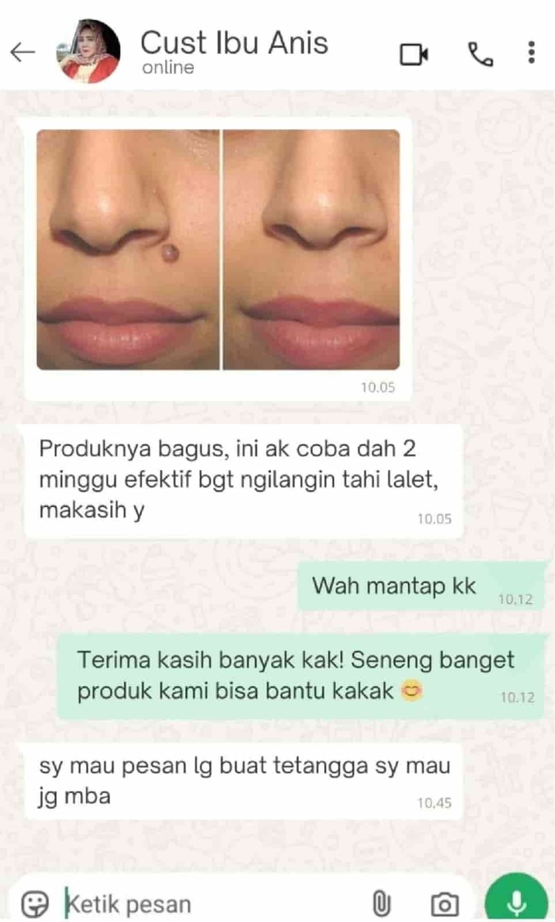 -