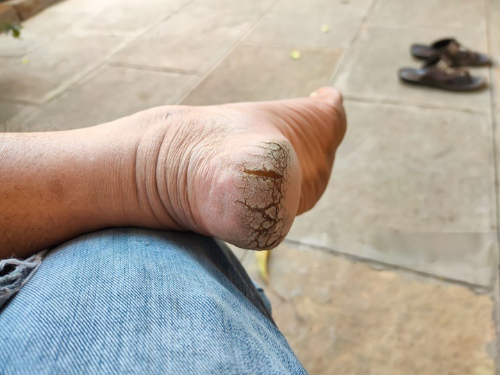 -