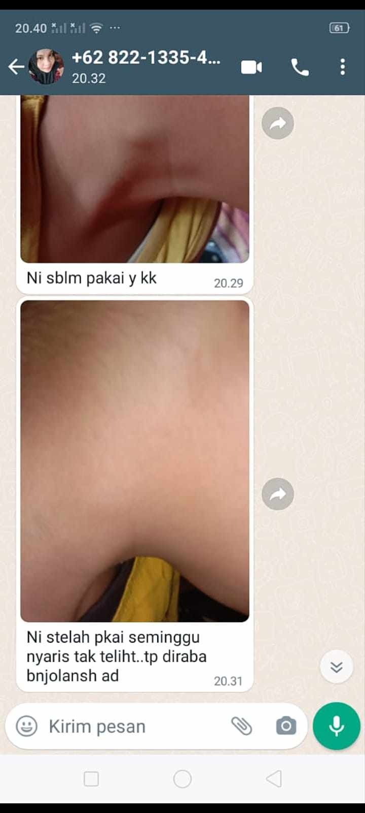 -
