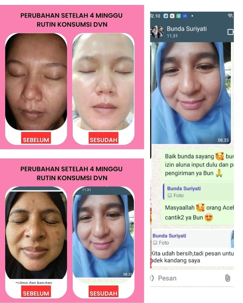 Efek Samping DVN Collagen