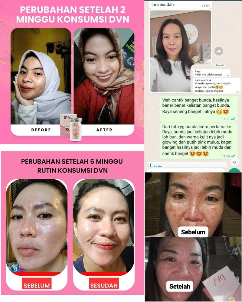DVN Collagen Adalah