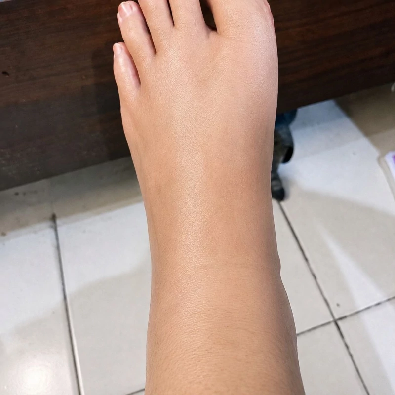 Kondisi Sesudah