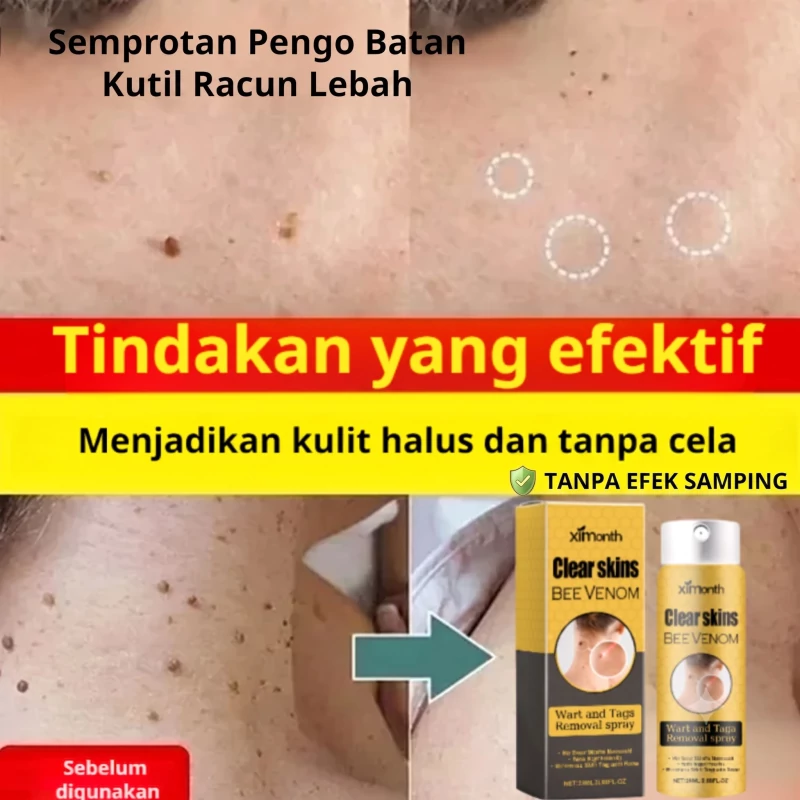 Gambar OsteoDeer Pro 6