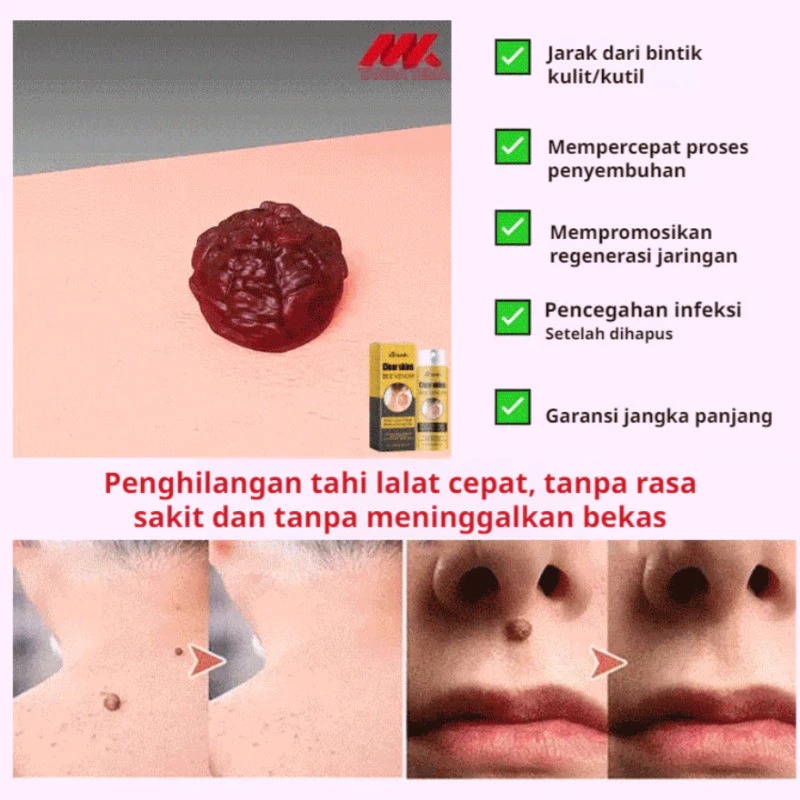 Gambar OsteoDeer Pro 4
