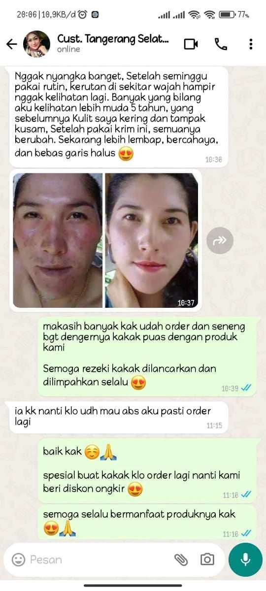 Testimoni Dragon Blood Skin Care 2