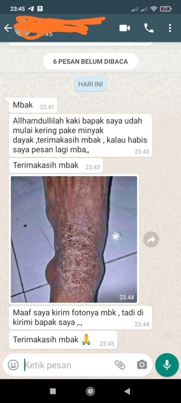 -