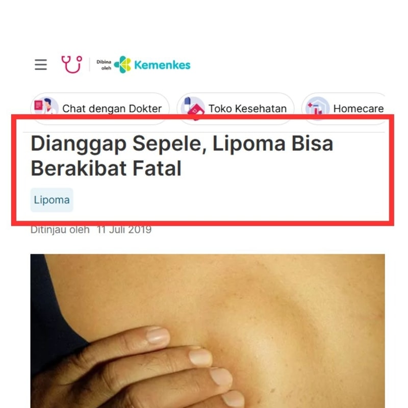 -