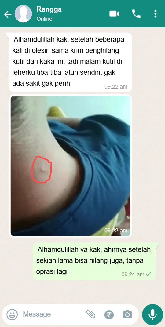 -