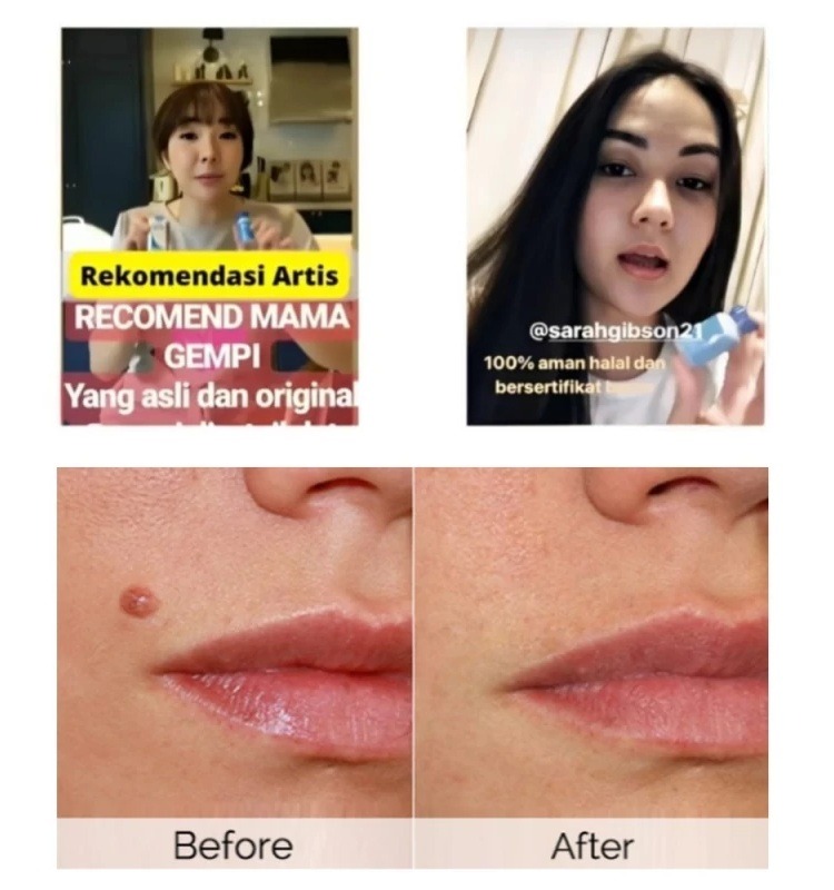 -