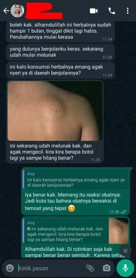 -