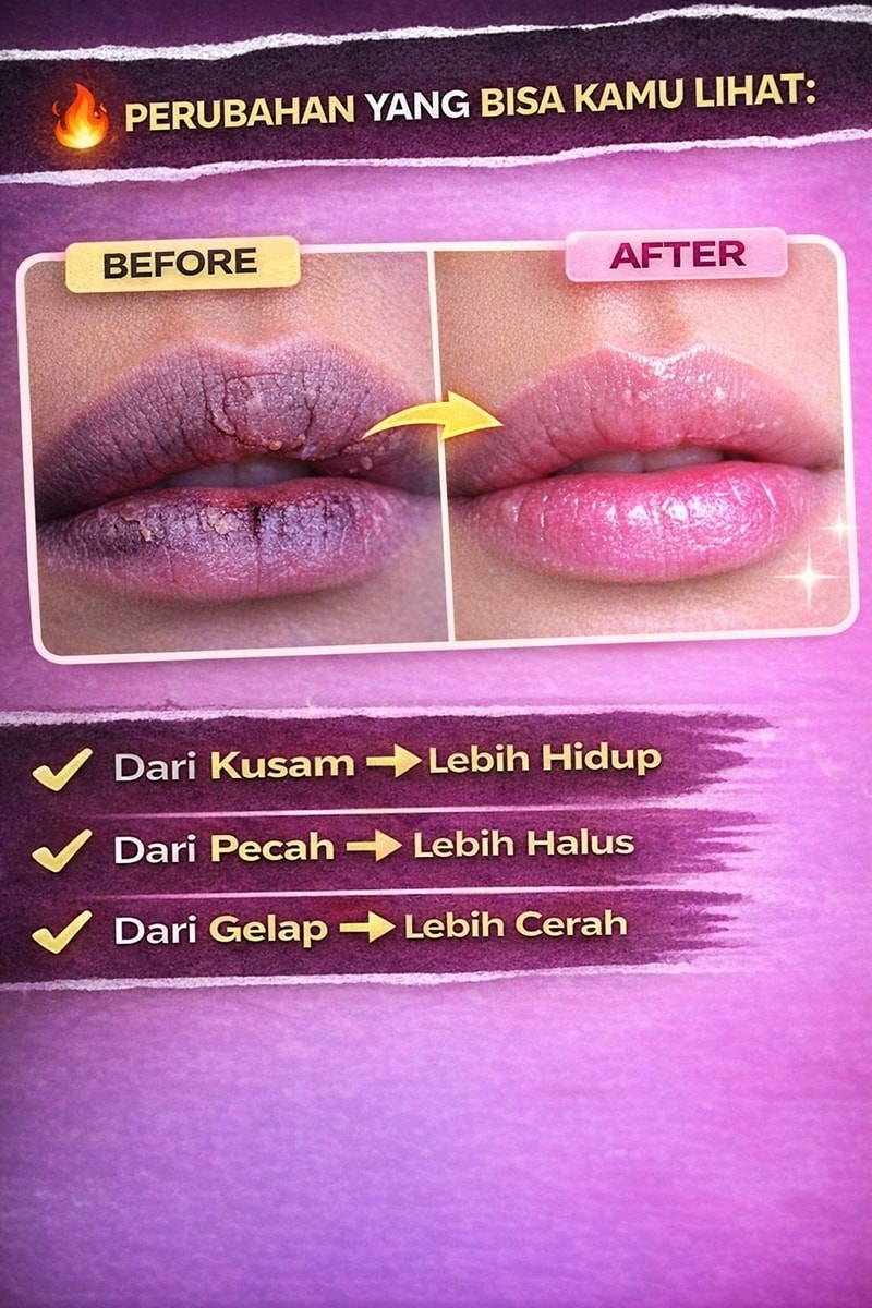 Beauty Of Angel Lip Serum — Promo Spesial B3 — Fitur & Manfaat 3