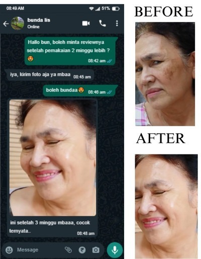 -