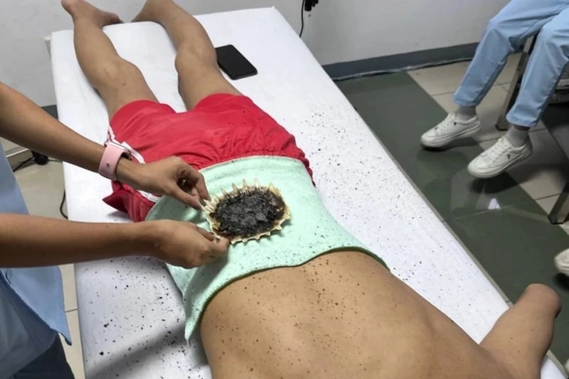 Cangkang Kura-Kura di Klinik Sinshe Ren Ai, pengobatan tradisional Tiongkok