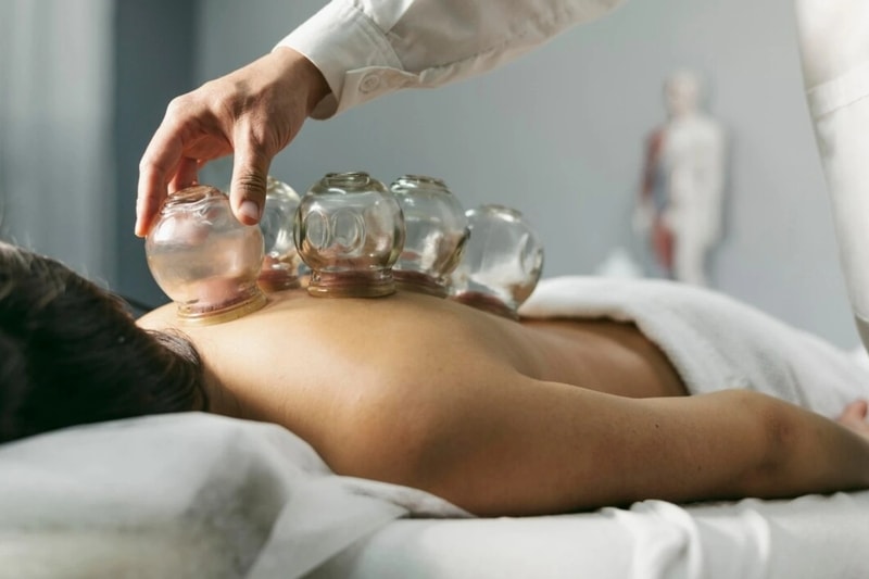 Bekam Alami di Klinik Sinshe Ren Ai, pengobatan tradisional Tiongkok