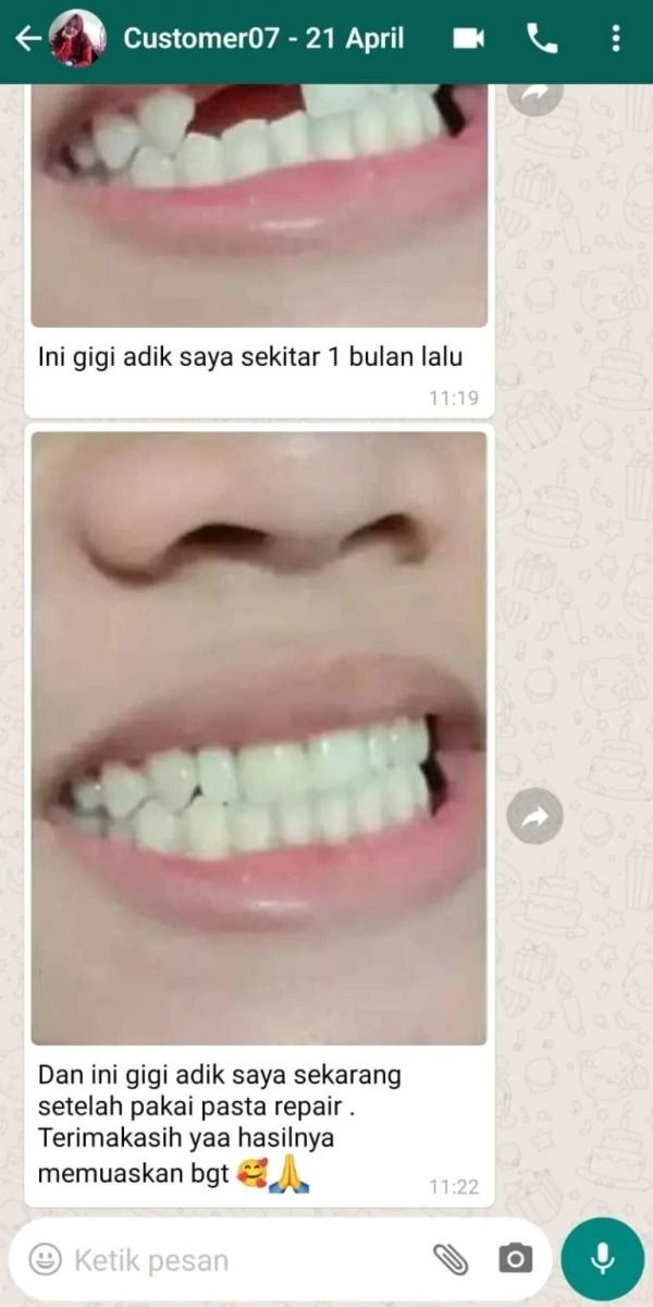 -