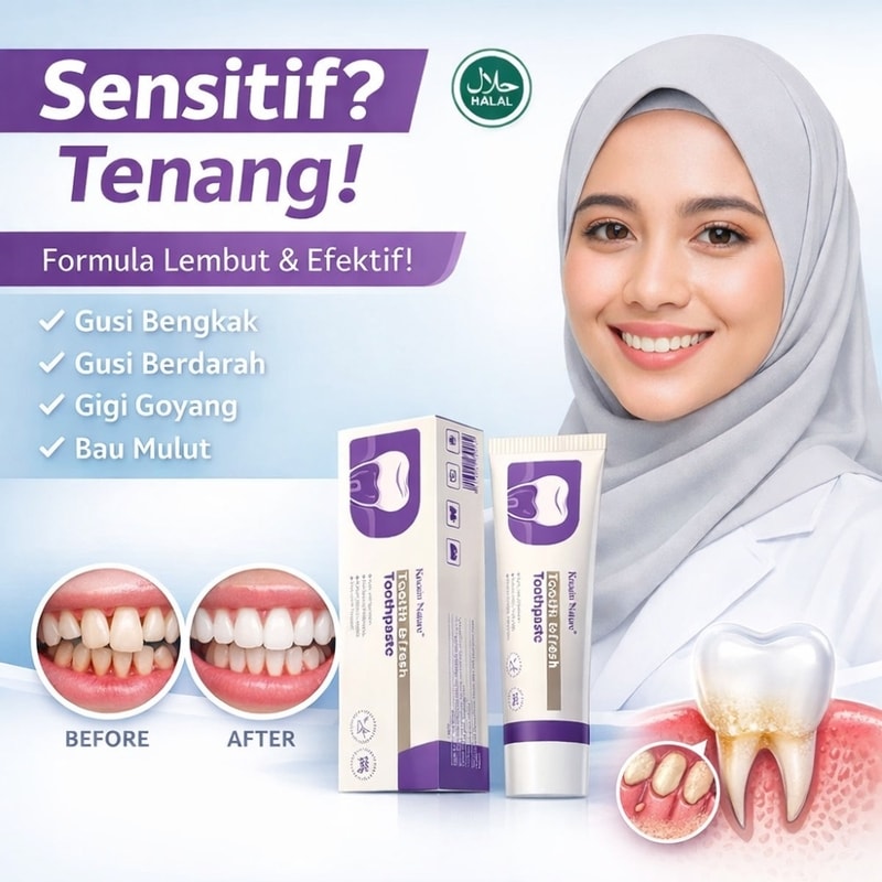 Penyebab Karang Gigi