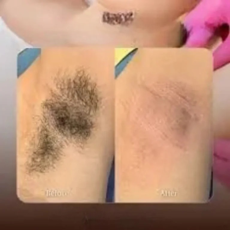-