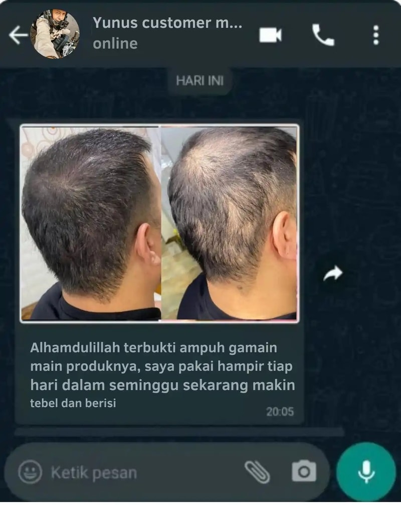 -