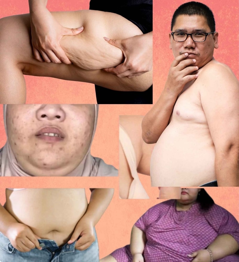 -