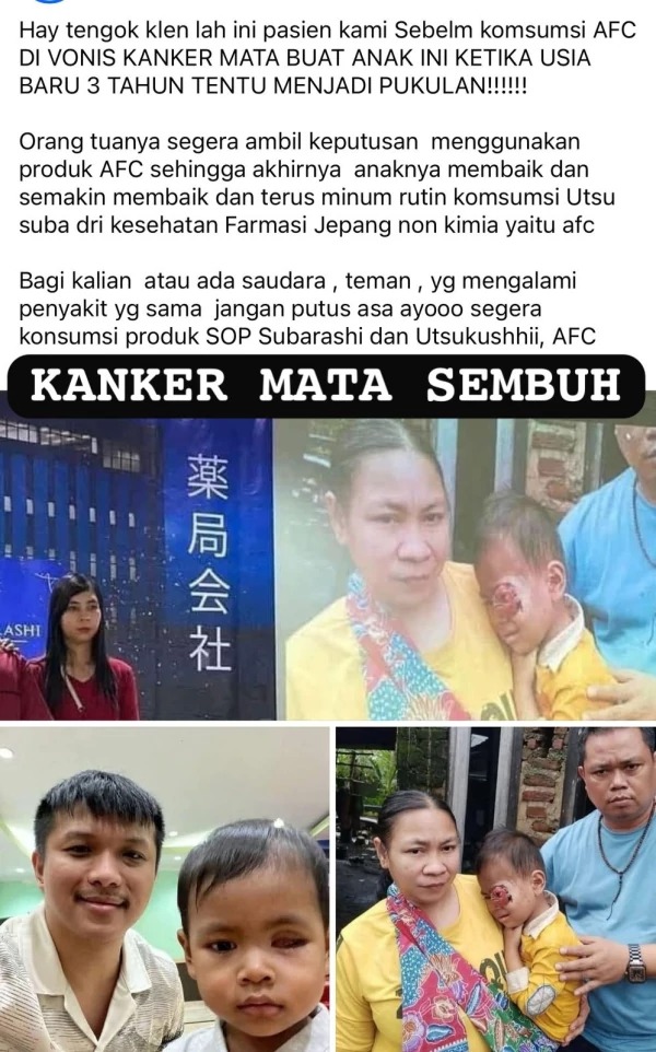 -