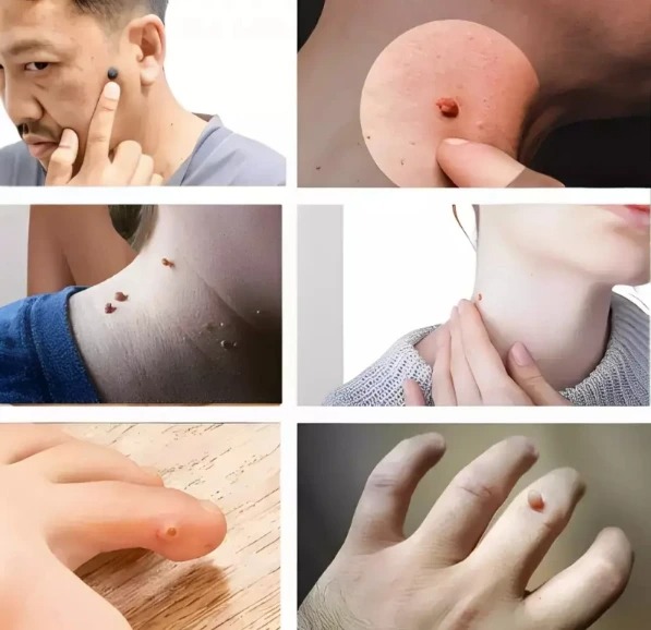 -