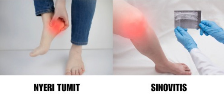 -