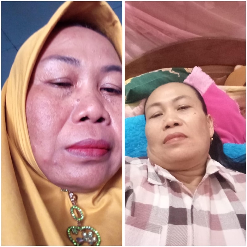 cara pakai dvn kolagen