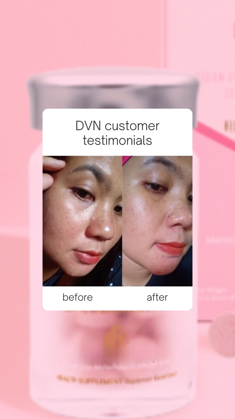 dvn collagen