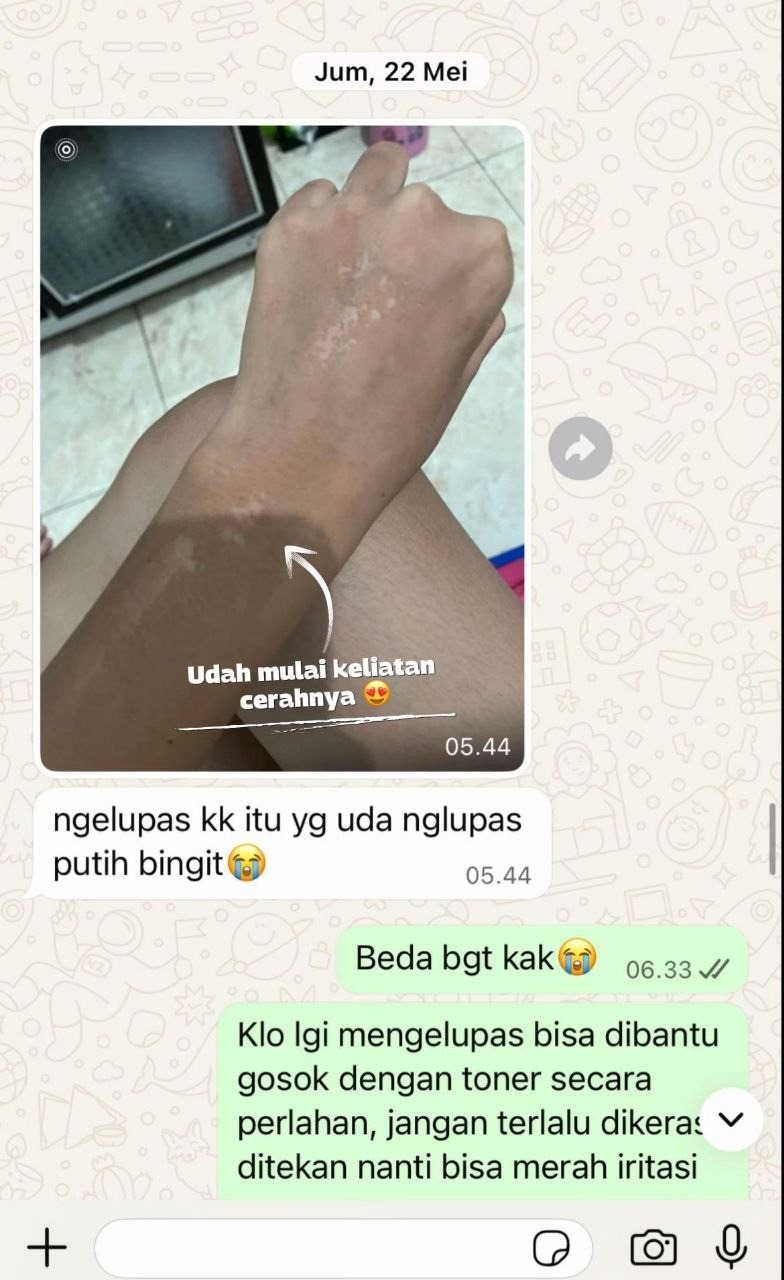 -