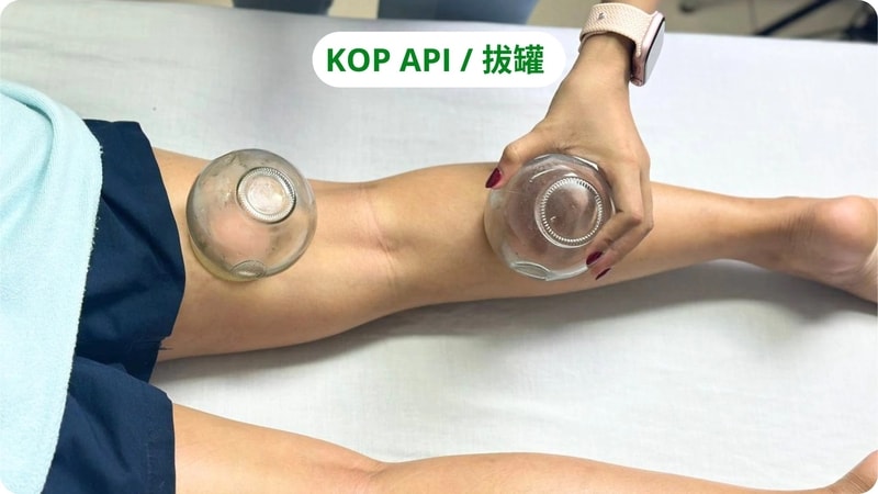 kop api