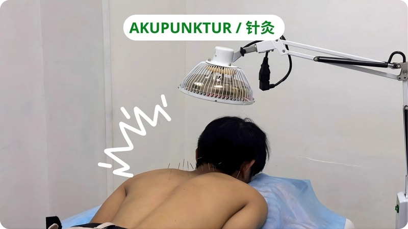 akupunktur