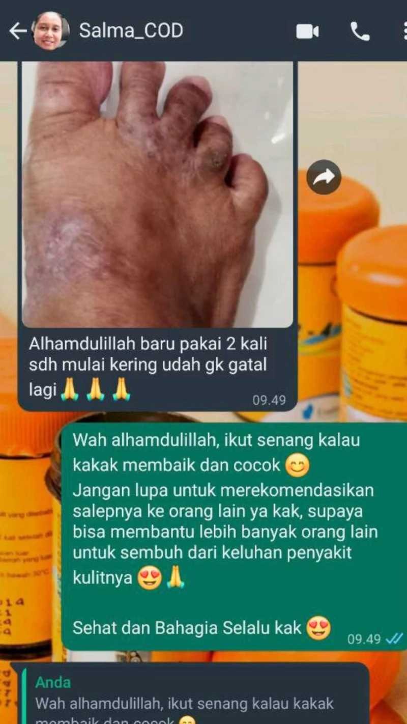 -
